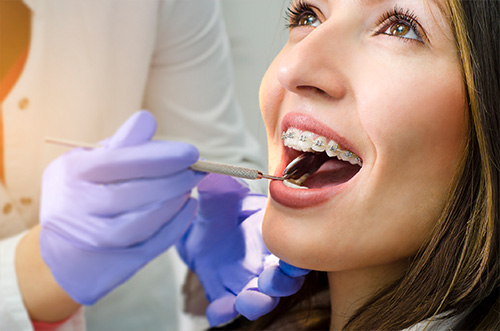 Orthodontics for Adults