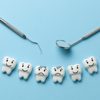 Considering White Fillings? Here's What You Need To Know
