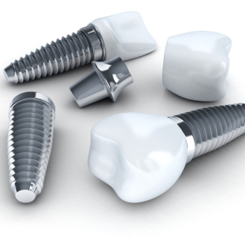 Banish Uncomfortable Bridges And Unsightly Gaps With Tooth Implants