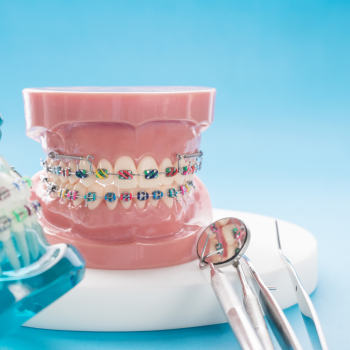 What is the difference between an Orthodontist and a Dentist?