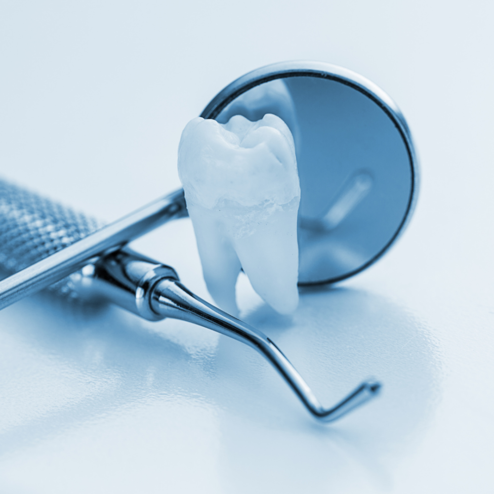 Have A Dental Emergency? You Need To Act Quickly.